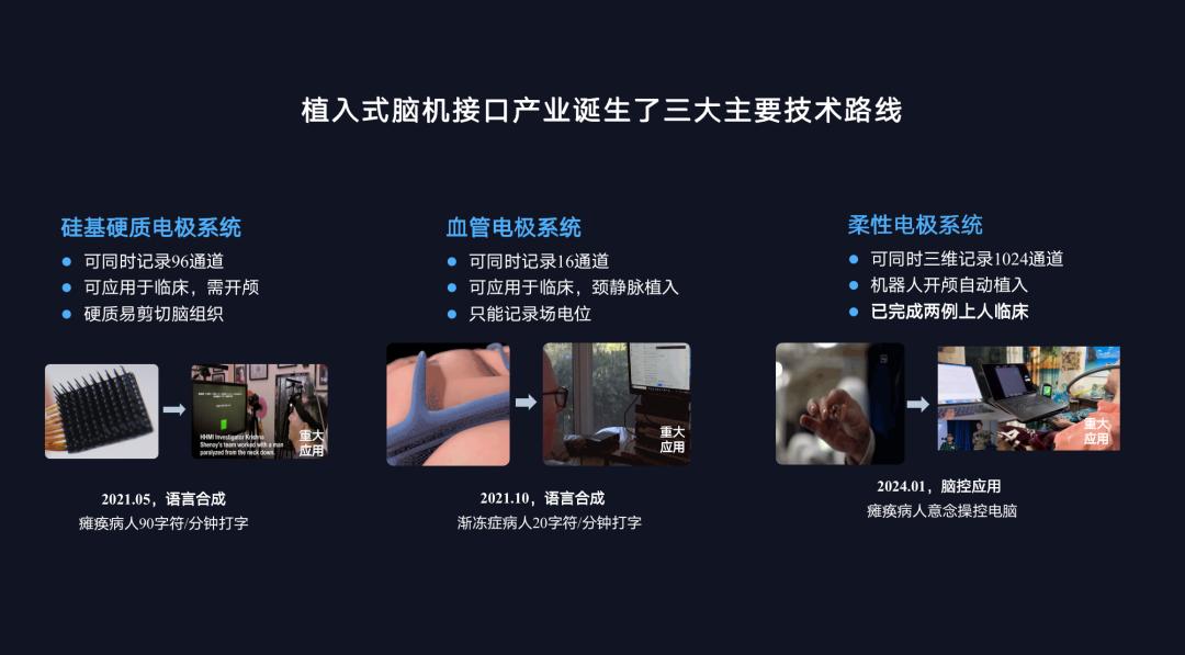 脑机接口和 AI,一个硬币的两面