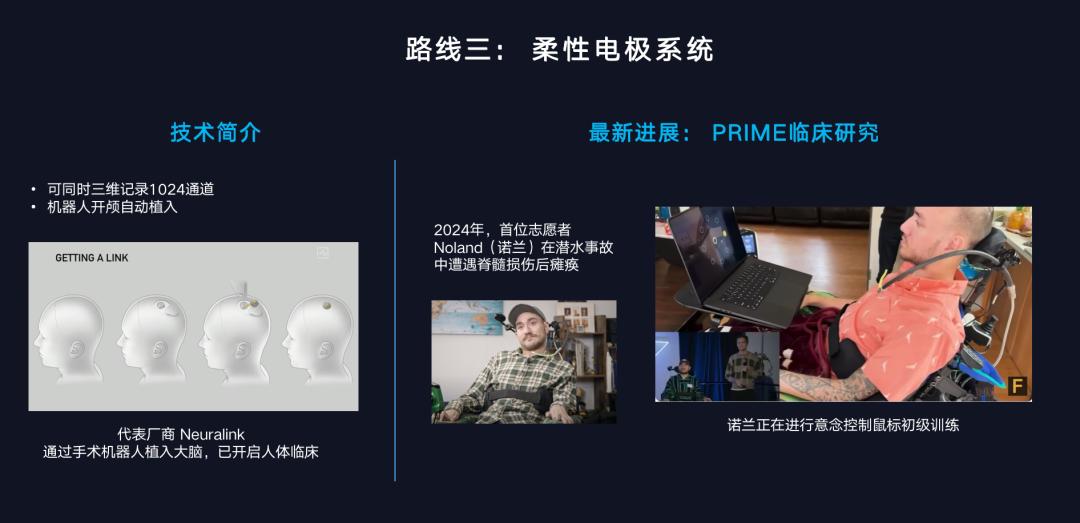 脑机接口和 AI,一个硬币的两面